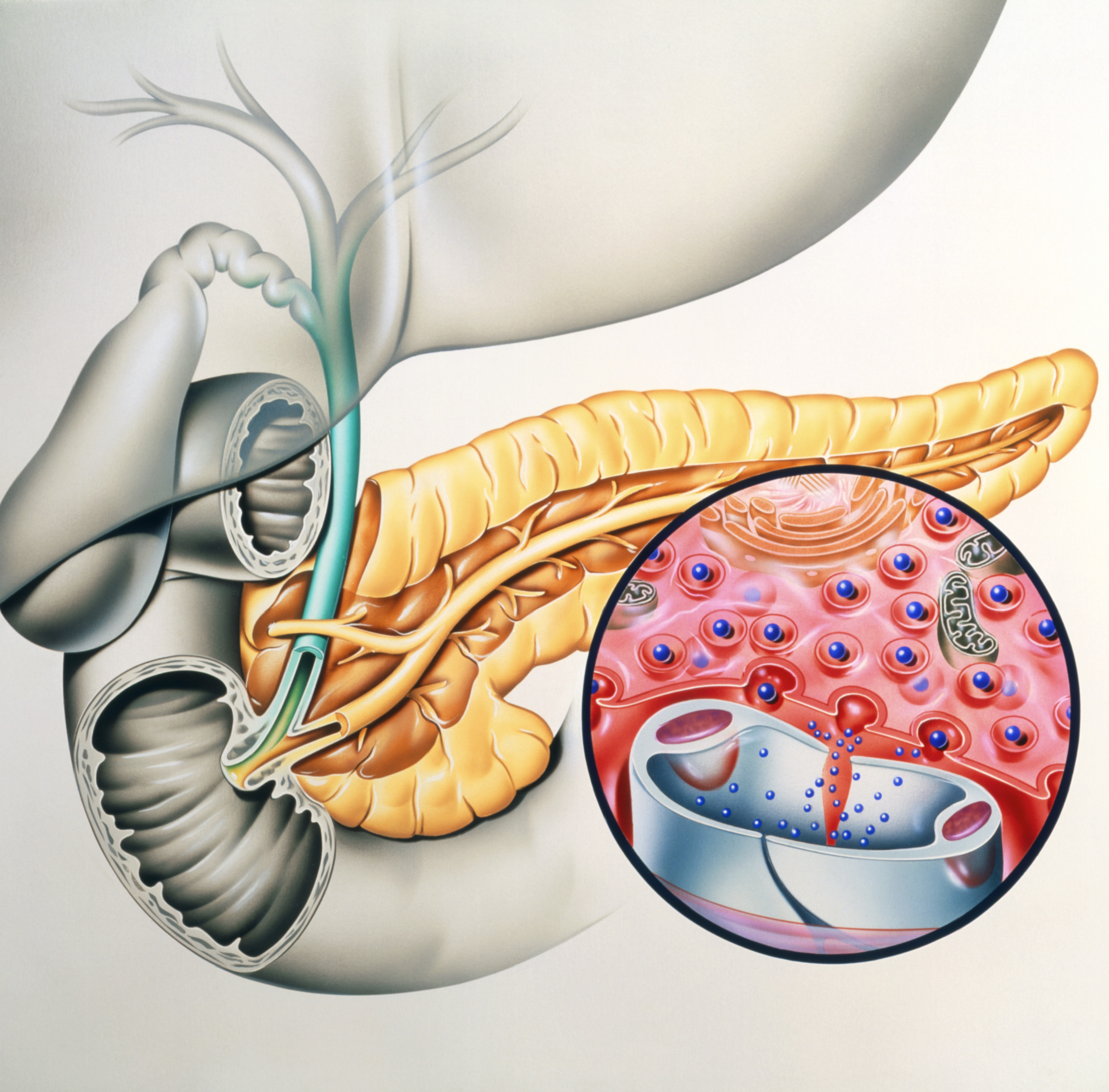 symptoms-of-pancreatic-cancer